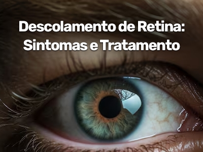Descolamento de Retina: Sintomas, Causas e Tratamento | SP